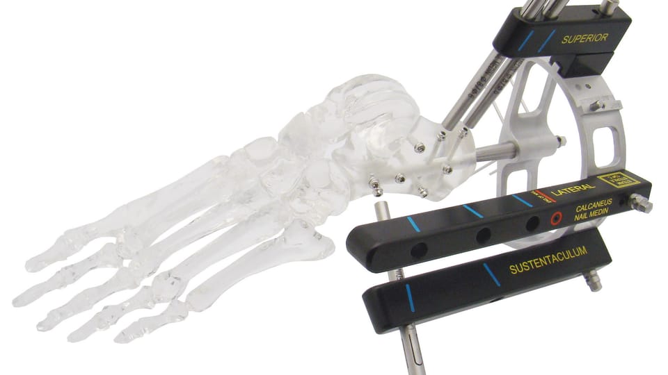 MEDIN - C-NAIL instrumentаrium, photo: archive of Association of Manufacturers and Suppliers of Medical Devices MEDIN - C-NAIL instrumentаrium, photo: archive of Association of Manufacturers and Suppliers of Medical Devices