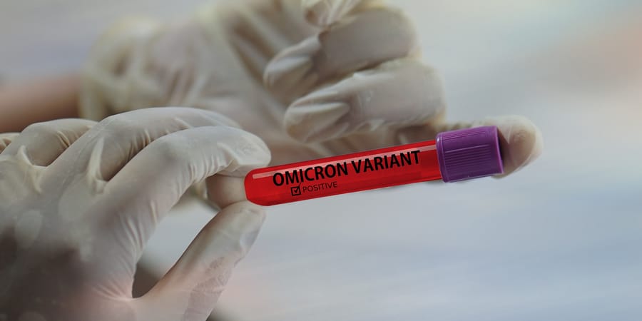 Covid: Omicron surge behind record-high daily Czech caseload - Vimarsana News